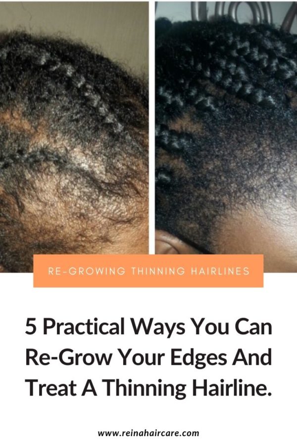 5 Ways You Can Regrow Your Edges And Nape Hairs Reina Haircare