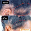 Hair Growth Set - Image 7